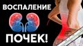 Когда аппетит исчезает: тревожные знаки хронической почечной недостаточности